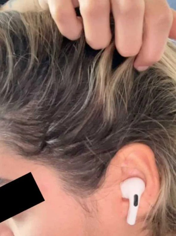 Customer result after