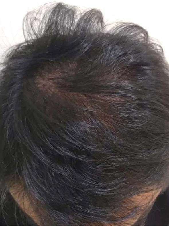 Customer result after