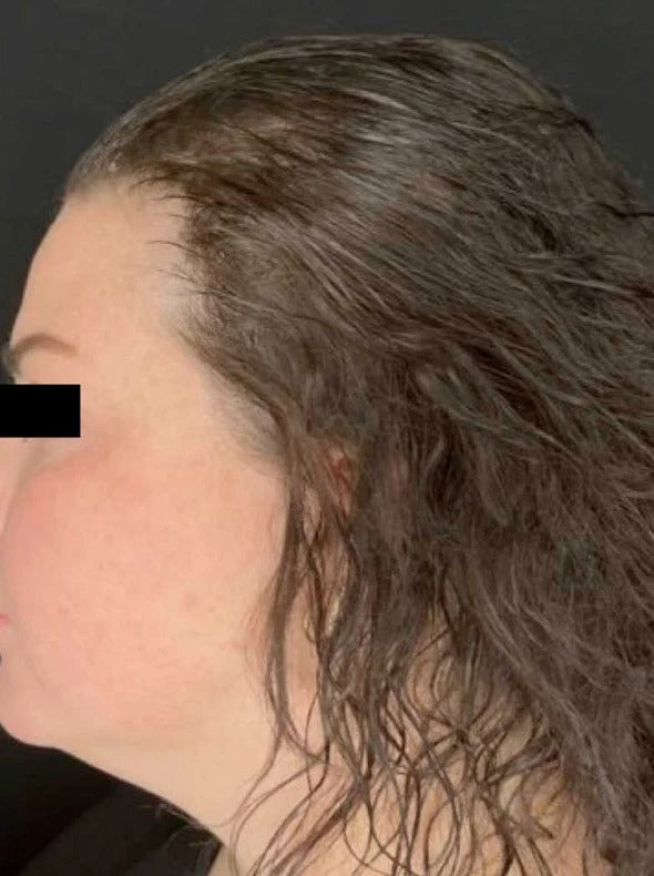 Customer result after