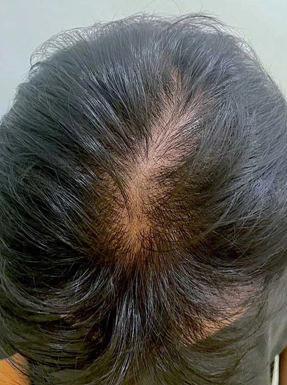 Customer result before
