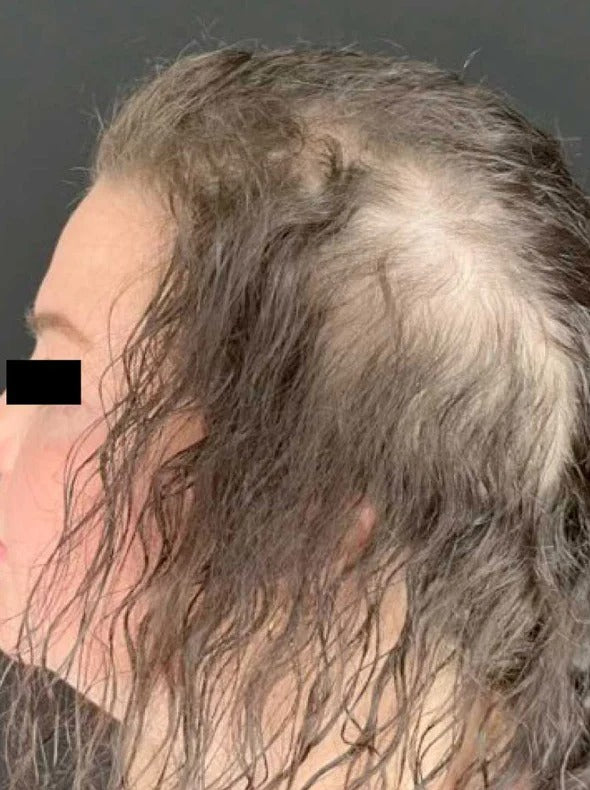 Customer result before