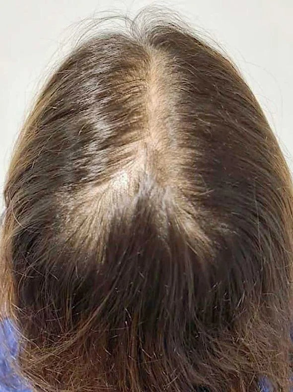 Customer result before